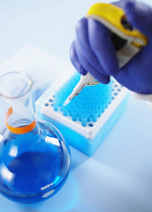 Human IGF-1 ELISA Kit